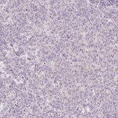 Anti-TSPAN8 antibody produced in rabbit Prestige Antibodies&#174; Powered by Atlas Antibodies, affinity isolated antibody, buffered aqueous glycerol solution