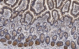 Anti-Gab1 Antibody, clone 4B20, ZooMAb&#174; Rabbit Monoclonal recombinant, expressed in HEK 293 cells
