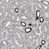 Anti-SSTR2 antibody produced in rabbit Prestige Antibodies&#174; Powered by Atlas Antibodies, affinity isolated antibody, buffered aqueous glycerol solution