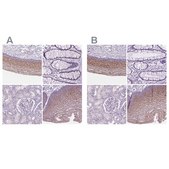 Anti-SBSN antibody produced in rabbit Prestige Antibodies&#174; Powered by Atlas Antibodies, affinity isolated antibody, buffered aqueous glycerol solution