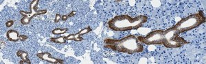 Anti-Sodium-Iodide Symporter Antibody, C-terminal 2 from rabbit