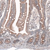 Monoclonal Anti--G6PC antibody produced in mouse Prestige Antibodies&#174; Powered by Atlas Antibodies, clone CL5818, purified immunoglobulin, buffered aqueous glycerol solution