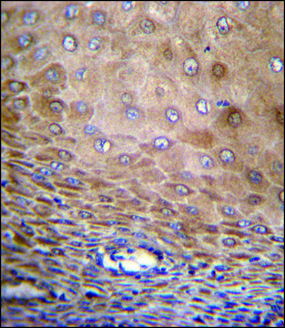 ANTI-TMEM43 (CENTER) antibody produced in rabbit IgG fraction of antiserum, buffered aqueous solution