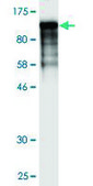 Monoclonal Anti-FLNA antibody produced in mouse clone 3B6-1D10, purified immunoglobulin, buffered aqueous solution