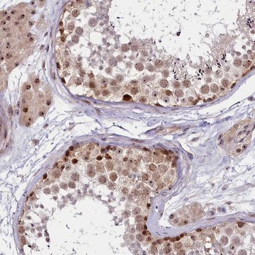 Anti-TCOF1 antibody produced in rabbit Prestige Antibodies&#174; Powered by Atlas Antibodies, affinity isolated antibody, buffered aqueous glycerol solution