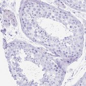 Anti-SLCO1B3 antibody produced in rabbit Prestige Antibodies&#174; Powered by Atlas Antibodies, affinity isolated antibody, buffered aqueous glycerol solution