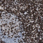 Anti-CD247 antibody produced in rabbit Prestige Antibodies&#174; Powered by Atlas Antibodies, affinity isolated antibody, buffered aqueous glycerol solution