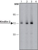 Anti-Kindlin-2 antibody produced in rabbit ~1.0&#160;mg/mL, affinity isolated antibody, buffered aqueous solution
