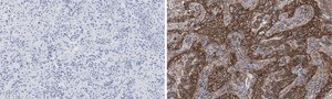 Anti-Integrin pan-&#945;V Antibody, clone EM01309 , ZooMAb&#174; Rabbit Monoclonal recombinant, expressed in HEK 293 cells