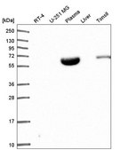 Anti-NARF antibody produced in rabbit Prestige Antibodies&#174; Powered by Atlas Antibodies, affinity isolated antibody