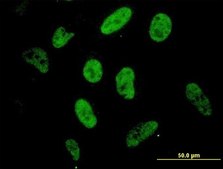 ANTI-SP1 antibody produced in mouse clone 4H6, purified immunoglobulin, buffered aqueous solution