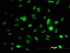 Monoclonal Anti-STK6 antibody produced in mouse clone 5F8, purified immunoglobulin, buffered aqueous solution