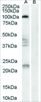 Anti-NOGO 66 Receptor antibody produced in goat affinity isolated antibody, buffered aqueous solution