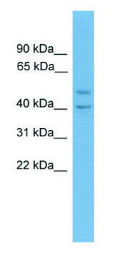 Anti-INHBA (N-terminal) antibody produced in rabbit affinity isolated antibody