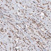 Monoclonal Anti-SMCHD1 antibody produced in mouse Prestige Antibodies&#174; Powered by Atlas Antibodies, clone CL4265, purified immunoglobulin