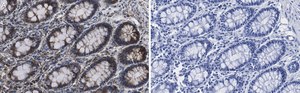 Anti-Mn-SOD Antibody, clone 1C14 ZooMAb&#174; Rabbit Monoclonal recombinant, expressed in HEK 293 cells
