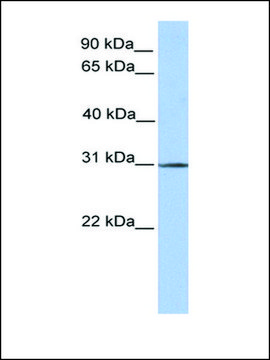 Anti-SURF4 antibody produced in rabbit affinity isolated antibody