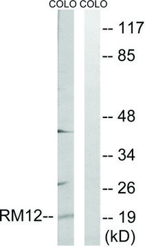 Anti-MRPL12 antibody produced in rabbit affinity isolated antibody