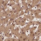 Anti-PSMD1 antibody produced in rabbit Prestige Antibodies&#174; Powered by Atlas Antibodies, affinity isolated antibody, buffered aqueous glycerol solution