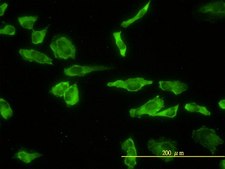 Monoclonal Anti-ACP2 antibody produced in mouse clone M1-4A12, purified immunoglobulin, buffered aqueous solution