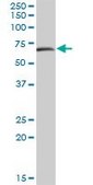 Anti-MAOA antibody produced in mouse IgG fraction of antiserum, buffered aqueous solution