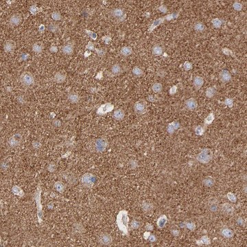Anti-CPE antibody produced in rabbit Prestige Antibodies&#174; Powered by Atlas Antibodies, affinity isolated antibody, buffered aqueous glycerol solution