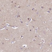 Anti-GABRD antibody produced in rabbit Prestige Antibodies&#174; Powered by Atlas Antibodies, affinity isolated antibody, buffered aqueous glycerol solution
