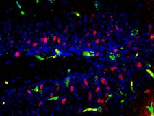 Anti-Caspase 3 Antibody, active (cleaved) form Chemicon&#174;, from rabbit