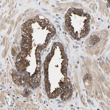 Anti-LRBA antibody produced in rabbit Prestige Antibodies&#174; Powered by Atlas Antibodies, affinity isolated antibody, buffered aqueous glycerol solution, Ab1