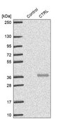 Anti-CTRL antibody produced in rabbit Prestige Antibodies&#174; Powered by Atlas Antibodies, affinity isolated antibody, buffered aqueous glycerol solution