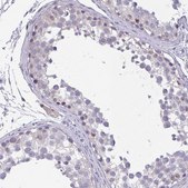Anti-RBL1 antibody produced in rabbit Prestige Antibodies&#174; Powered by Atlas Antibodies, affinity isolated antibody, buffered aqueous glycerol solution