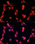 Anti- EGFR antibody produced in rabbit