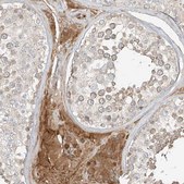 Anti-FSTL1 antibody produced in rabbit Prestige Antibodies&#174; Powered by Atlas Antibodies, affinity isolated antibody, buffered aqueous glycerol solution