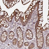 Anti-CYP27A1 antibody produced in rabbit Prestige Antibodies&#174; Powered by Atlas Antibodies, affinity isolated antibody, buffered aqueous glycerol solution