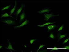 Monoclonal Anti-SERPINA3, (C-terminal) antibody produced in mouse clone 1C10, purified immunoglobulin, buffered aqueous solution