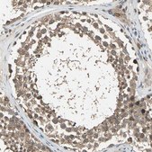 Anti-NFKBIE antibody produced in rabbit Ab2, Prestige Antibodies&#174; Powered by Atlas Antibodies, affinity isolated antibody, buffered aqueous glycerol solution