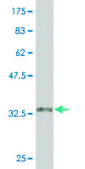 Monoclonal Anti-CARM1 antibody produced in mouse clone 6G9, purified immunoglobulin, buffered aqueous solution