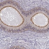 Anti-ZNF185 antibody produced in rabbit Prestige Antibodies&#174; Powered by Atlas Antibodies, affinity isolated antibody, buffered aqueous glycerol solution