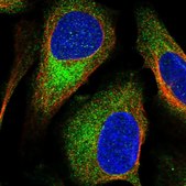 Anti-TSC2 antibody produced in rabbit Prestige Antibodies&#174; Powered by Atlas Antibodies, affinity isolated antibody, buffered aqueous glycerol solution