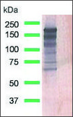 Anti-EGFR antibody, Rabbit monoclonal clone SP111, recombinant, expressed in proprietary host, affinity isolated antibody