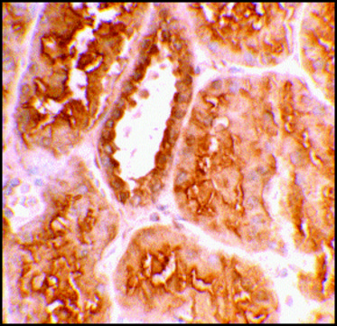 Anti-ACE2 antibody produced in rabbit affinity isolated antibody