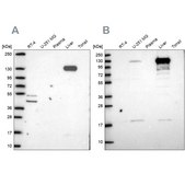 Anti-PC antibody produced in rabbit Prestige Antibodies&#174; Powered by Atlas Antibodies, affinity isolated antibody