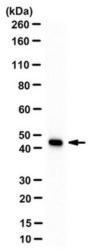 Anti-Actin, smooth muscle Antibody, clone ASM-1/1A4 clone ASM-1 (1A4), from mouse