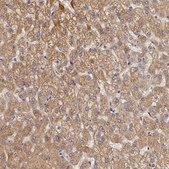 Anti-OTC antibody produced in rabbit Ab2, Prestige Antibodies&#174; Powered by Atlas Antibodies, affinity isolated antibody, buffered aqueous glycerol solution