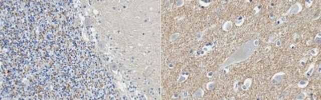 Anti-Catenin Delta-2 Antibody, clone 12B4 clone 12B4.1, from mouse