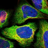 Anti-RTN4 antibody produced in rabbit Prestige Antibodies&#174; Powered by Atlas Antibodies, affinity isolated antibody, buffered aqueous glycerol solution