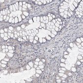 Anti-CA6 antibody produced in rabbit Prestige Antibodies&#174; Powered by Atlas Antibodies, affinity isolated antibody, buffered aqueous glycerol solution, ab2