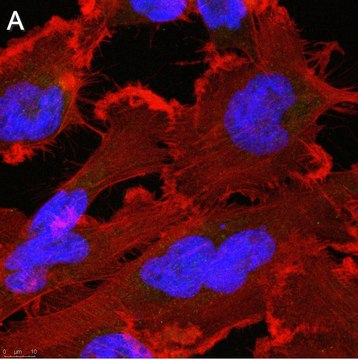 Anti-p62/SQSTM1 Antibody, clone 2D14 ZooMAb&#174; Rabbit Monoclonal recombinant, expressed in HEK 293 cells