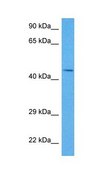 Anti-SerPINE1 (AB1) antibody produced in rabbit affinity isolated antibody