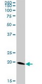 Anti-FTH1 antibody produced in mouse purified immunoglobulin, buffered aqueous solution
